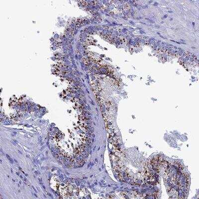 Immunohistochemistry-Paraffin: TRPM5 Antibody [NBP2-48760] - Staining of human prostate shows strong granular cytoplasmic positivity in glandular cells.