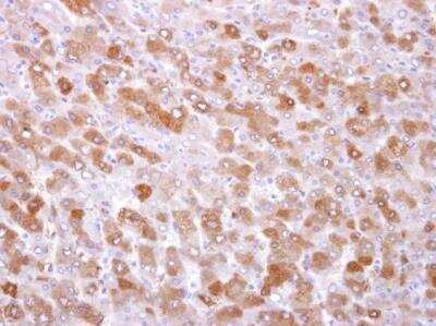 Immunohistochemistry-Paraffin: TRPM7 Antibody [NBP2-20739] -  Human normal liver. TRPM7 antibody [C3], C-term dilution: 1:250. Antigen Retrieval: Trilogy™ (EDTA based, pH 8.0) buffer, 15min. 