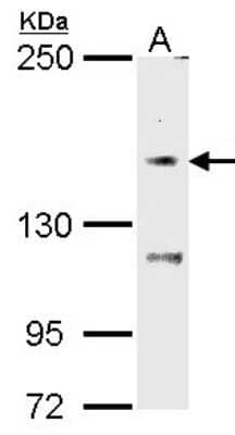 Western Blot: TRPM7 Antibody [NBP2-20739] - Sample (30 ug of whole cell lysate) A: HCT116 5% SDS PAGE gel, diluted at 1:1000.