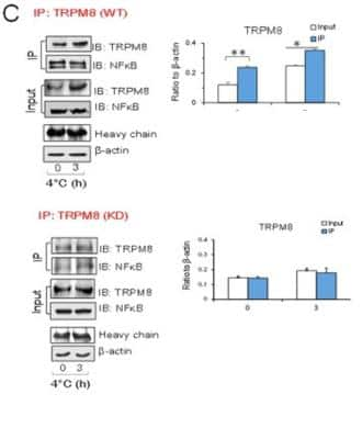 Knockdown Validated: TRPM8 Antibody [NBP1-97311] - The results of co-immunoprecipitation (CoIP) confirmed interaction between NFkB and TRPM8. CoIPs were also performed with TRPM8 antibodies. Western blot analysis was carried out by TRPM8 and NFkB. Data are shown as the mean +/- S.D. from three experiments. *P &lt; 0.05; **P &lt; 0.01. Image collected and cropped by CiteAb from the following publication (https://www.nature.com/articles/srep45155) licensed under a CC-BY license.