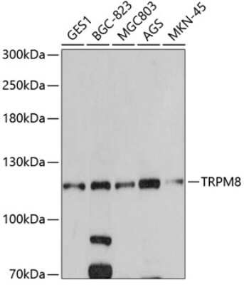 Western Blot: TRPM8 Antibody [NBP2-94139] - Analysis of extracts of various cell lines, using TRPM8 at 1:500 dilution. Secondary antibody: HRP Goat Anti-Rabbit IgG (H+L) at 1:10000 dilution. Lysates/proteins: 25ug per lane. Blocking buffer: 3% nonfat dry milk in TBST. Detection: ECL Basic Kit . Exposure time: 60s.