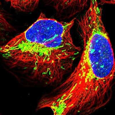 Immunocytochemistry/ Immunofluorescence TRPT1 Antibody - BSA Free