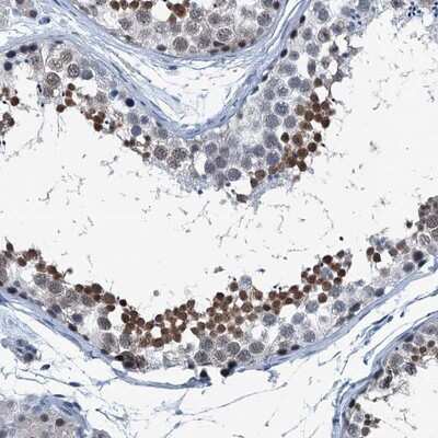 Immunohistochemistry-Paraffin: TRPT1 Antibody [NBP1-81230] - Staining of human testis shows moderate nuclear positivity in cells in seminiferus ducts.