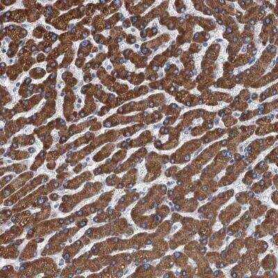 Immunohistochemistry-Paraffin: TRPT1 Antibody [NBP2-32642] - Staining of human liver shows strong granular cytoplasmic positivity in hepatocytes.