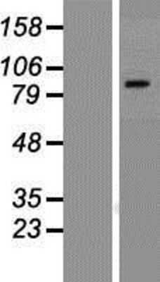 Western Blot: TRPV1 Overexpression Lysate (Adult Normal) [NBP2-06759] Left-Empty vector transfected control cell lysate (HEK293 cell lysate); Right -Over-expression Lysate for TRPV1.