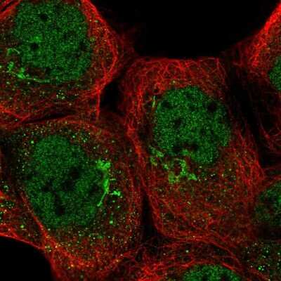 Immunocytochemistry/Immunofluorescence: TRRAP Antibody [NBP2-58076] - Staining of human cell line A-431 shows localization to nucleoplasm & the Golgi apparatus. Antibody staining is shown in green. 