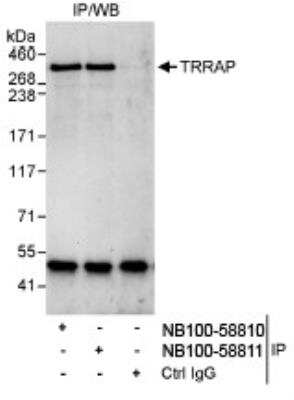 Immunoprecipitation: TRRAP Antibody [NB100-58810] - Detection of Human TRRAP by Western Blot of Immunoprecipitates.  Samples: Whole cell lysate (1 mg for IP, 20% of IP loaded) from HeLa cells. Antibodies: Affinity purified rabbit anti-TRRAP antibody NB100-58810 used for IP at 3 mcg/mg lysate. TRRAP was also immunoprecipitated by rabbit anti- TRRAP antibody NB100-58811, which recognizes a downstream epitope. Detection: Chemiluminescence with an exposure time of 30 seconds.