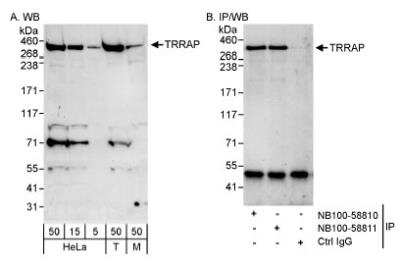 Western Blot: TRRAP Antibody [NB100-58811] - Detection of Human and Mouse TRRAP on HeLa whole cell lysate using NB100-58811. TRRAP was also immunoprecipitated by rabbit anti-TRRAP antibody NB100-58810.