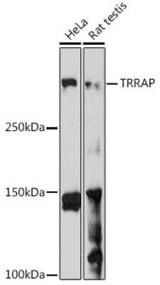 Western Blot: TRRAP Antibody [NBP3-15607] - Western blot analysis of extracts of various cell lines, using TRRAP antibody (NBP3-15607) at 1:1000 dilution. Secondary antibody: HRP Goat Anti-Rabbit IgG (H+L) at 1:10000 dilution. Lysates/proteins: 25ug per lane. Blocking buffer: 3% nonfat dry milk in TBST. Detection: ECL Enhanced Kit. Exposure time: 180s.