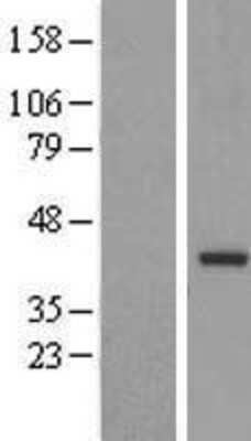 Western Blot: TRUB2 Overexpression Lysate (Adult Normal) [NBL1-17348] Left-Empty vector transfected control cell lysate (HEK293 cell lysate); Right -Over-expression Lysate for TRUB2.