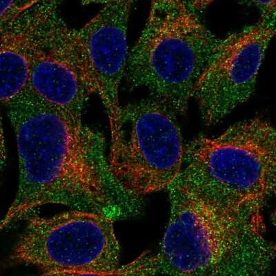 Immunocytochemistry/ Immunofluorescence TRUSS Antibody - BSA Free