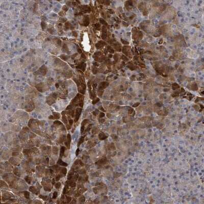 Immunohistochemistry: TRUSS Antibody [NBP2-47593] - Staining of human pancreas shows strong cytoplasmic positivity in exocrine glandular cells.