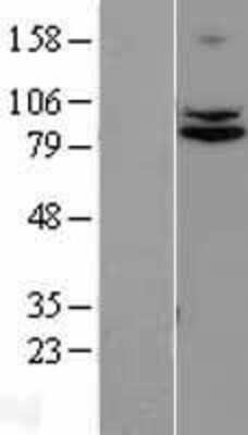 Western Blot: TRUSS Overexpression Lysate (Adult Normal) [NBL1-17333] Left-Empty vector transfected control cell lysate (HEK293 cell lysate); Right -Over-expression Lysate for TRUSS.