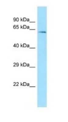 Western Blot: TRXR3 Antibody [NBP1-98287] - Titration: 1.0 ug/ml Positive Control: THP-1 Whole Cell.