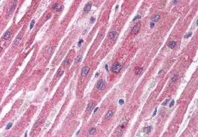 Immunohistochemistry-Paraffin: TSC1 Antibody [NB100-80855] - Staining of human heart. Immunohistochemistry of formalin-fixed, paraffin-embedded tissue after heat-induced antigen retrieval. Antibody concentration 5 ug/ml.