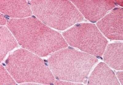 Immunohistochemistry-Paraffin: TSC1 Antibody [NB100-80855] - Staining of human skeletal muscle. Immunohistochemistry of formalin-fixed, paraffin-embedded tissue after heat-induced antigen retrieval. Antibody concentration 5 ug/ml.