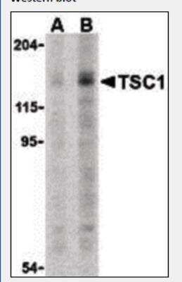 Western Blot: TSC1 Antibody [NB100-80855] - TSC1 in C2C12 cell lysate with TSC1 antibody at (A) 2 and (B) 4 ug.