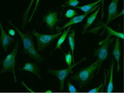 Immunocytochemistry/Immunofluorescence: TSC22/TSC22D1 Antibody (143) [NBP2-90145] - Immunofluorescence staining of Human TSC22D1 in Hela cells. Cells were fixed with 4% PFA, permeabilzed with 0.3% Triton X-100 in PBS, blocked with 10% serum, and incubated with rabbit anti-Human TSC22D1 monoclonal antibody (1:60) at 37? 1 hour. Then cells were stained with the Alexa Fluor(R) 488-conjugated Goat Anti-rabbit IgG secondary antibody (green) and counterstained with DAPI (blue). Positive staining was localized to nucleus and cytoplasm.