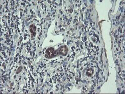 Immunohistochemistry: TSC22/TSC22D1 Antibody (OTI4H8) - Azide and BSA Free [NBP2-74654] - Analysis of Carcinoma of Human kidney tissue.