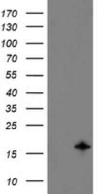 Western Blot: TSC22/TSC22D1 Antibody (OTI4H8) - Azide and BSA Free [NBP2-74654] - Analysis of HEK293T cells were transfected with the pCMV6-ENTRY control (Left lane) or pCMV6-ENTRY TSC22D1.