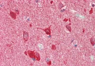 Immunohistochemistry-Paraffin: TSC22D2 Antibody [NBP2-88499] - Rabbit Anti-TSC22D2 antibody. Formalin Fixed Paraffin Embedded Tissue: Human Brain, Cortex. Primary antibody Concentration: 1:100. Secondary Antibody: Donkey anti-Rabbit-Cy3. Secondary Antibody Concentration: 1:200.