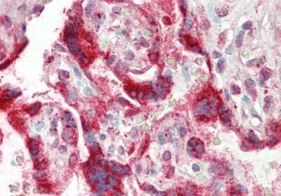 Immunohistochemistry-Paraffin: TSC22D2 Antibody [NBP2-88499] - Rabbit Anti-TSC22D2 antibody. Formalin Fixed Paraffin Embedded Tissue: Human Placenta. Primary antibody Concentration: 1:100. Secondary Antibody: Donkey anti-Rabbit-Cy3. Secondary Antibody Concentration: 1:200. Magnification: 20x