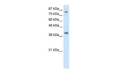 Western Blot: TSC22D2 Antibody [NBP2-88497] - WB Suggested Anti-TSC22D2 Antibody Titration: 2.5ug/ml. Positive Control: Transfected 293T