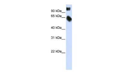 Western Blot: TSC22D2 Antibody [NBP2-88498] - WB Suggested Anti-TSC22D2 Antibody Titration: 0.2-1 ug/ml. ELISA Titer: 1:62500. Positive Control: Transfected 293T