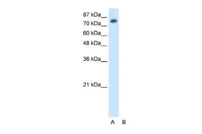 Western Blot: TSC22D2 Antibody [NBP2-88499] - WB Suggested Anti-TSC22D2 Antibody Titration: 0.2-1 ug/ml. ELISA Titer: 1:12500. Positive Control: HepG2 cell lysate