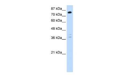 Western Blot: TSC22D2 Antibody [NBP2-88500] - WB Suggested Anti-TSC22D2 Antibody Titration: 0.2-1 ug/ml. Positive Control: Jurkat cell lysate