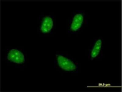 Immunocytochemistry/Immunofluorescence: TSC22D4 Antibody (1A4) [H00081628-M01] - Analysis of monoclonal antibody to TSC22D4 on HeLa cell . Antibody concentration 10 ug/ml.