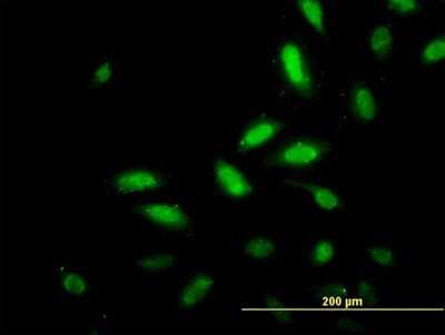 Immunocytochemistry/Immunofluorescence: TSC22D4 Antibody (4G7) [H00081628-M07] - Analysis of monoclonal antibody to TSC22D4 on HeLa cell. Antibody concentration 10 ug/ml