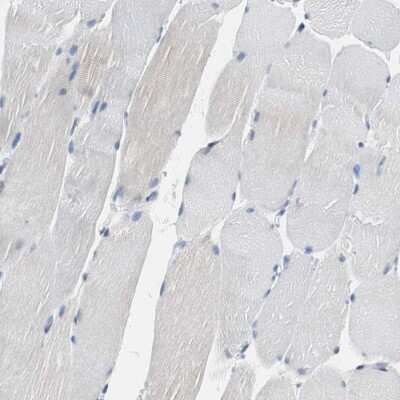Immunohistochemistry-Paraffin: TSC22D4 Antibody [NBP1-80688] - Staining of human skeletal muscle shows no positivity in myocytes as expected.