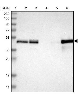Western Blot: TSC22D4 Antibody [NBP1-80688] - Lane 1: Marker  [kDa] 230, 130, 95, 72, 56, 36, 28, 17, 11.  Lane 2: Human cell line RT-4.  Lane 3: Human cell line U-251MG sp.  Lane 4: Human plasma (IgG/HSA depleted).  Lane 5: Human liver tissue.  Lane 6: Human tonsil tissue