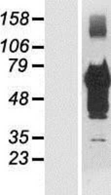 Western Blot: TSC22D4 Overexpression Lysate (Adult Normal) [NBP2-06160] Left-Empty vector transfected control cell lysate (HEK293 cell lysate); Right -Over-expression Lysate for TSC22D4.