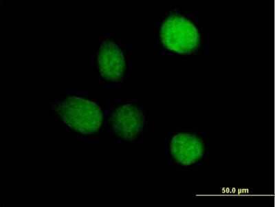 Immunocytochemistry/Immunofluorescence: TSEN2 Antibody [H00080746-B01P] - Analysis of purified antibody to TSEN2 on HeLa cell. (antibody concentration 10 ug/ml)