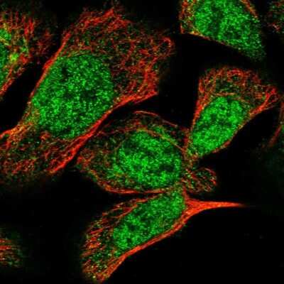 Immunocytochemistry/ Immunofluorescence TSEN2 Antibody