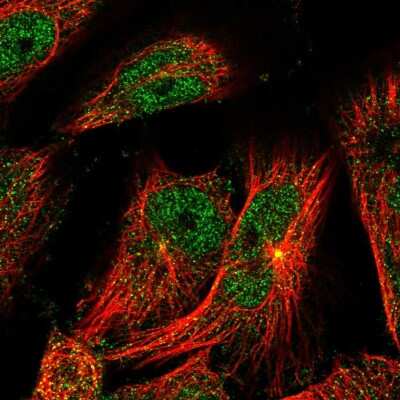 Immunocytochemistry/Immunofluorescence: TSEN2 Antibody [NBP1-81141] - Immunofluorescent staining of human cell line U-251 MG shows localization to nucleoplasm, cytosol & centrosome.