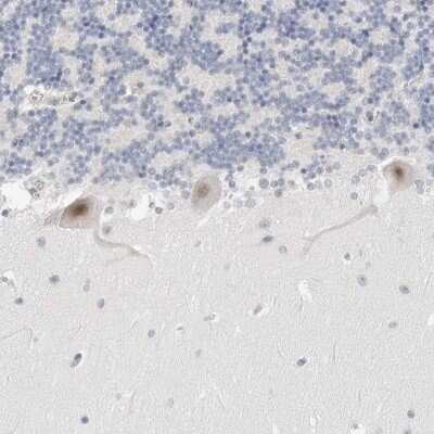 Immunohistochemistry-Paraffin TSEN2 Antibody