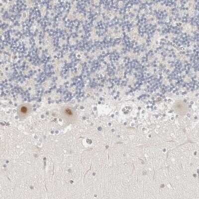 Immunohistochemistry-Paraffin: TSEN2 Antibody [NBP1-81141] - Staining of human cerebellum shows distinct nuclear positivity in Purkinje cells.