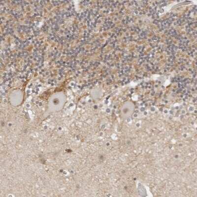 Immunohistochemistry-Paraffin: TSEN2 Antibody [NBP1-81142] - Staining of human cerebellum shows nuclear positivity in Purkinje cells.