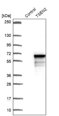 Western Blot TSEN2 Antibody