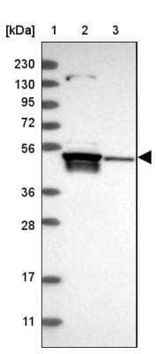 Western Blot: TSEN2 Antibody [NBP1-81141] - Lane 1: Marker  [kDa] 230, 130, 95, 72, 56, 36, 28, 17, 11.  Lane 2: Human cell line RT-4.  Lane 3: Human cell line U-251MG sp