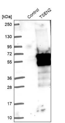 Western Blot: TSEN2 Antibody [NBP1-81142] - Analysis in control (vector only transfected HEK293T lysate) and TSEN2 over-expression lysate (Co-expressed with a C-terminal myc-DDK tag (3.1 kDa) in mammalian HEK293T cells).