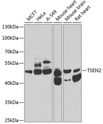 Western Blot: TSEN2 Antibody [NBP2-94310] - Analysis of extracts of various cell lines, using TSEN2 at 1:1000 dilution. Secondary antibody: HRP Goat Anti-Rabbit IgG (H+L) at 1:10000 dilution. Lysates/proteins: 25ug per lane. Blocking buffer: 3% nonfat dry milk in TBST. Detection: ECL Basic Kit . Exposure time: 90s.