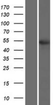 Western Blot: TSEN2 Overexpression Lysate (Adult Normal) [NBP2-06223] Left-Empty vector transfected control cell lysate (HEK293 cell lysate); Right -Over-expression Lysate for TSEN2.