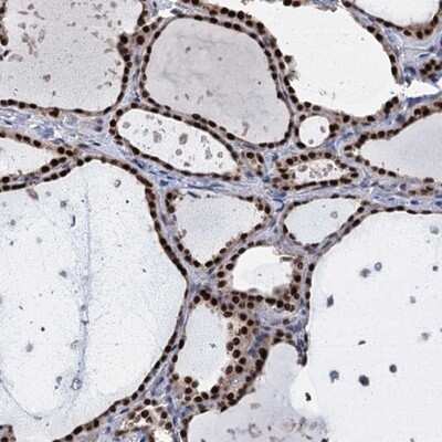 Immunohistochemistry-Paraffin TSEN34 Antibody