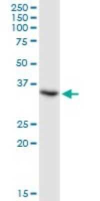 Western Blot: TSEN34 Antibody [H00079042-B01P] - Analysis of TSEN34 expression in HeLa.