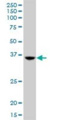 Western Blot: TSEN34 Antibody [H00079042-B01P] - Analysis of TSEN34 expression in Hela S3 NE.