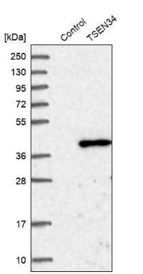 Western Blot TSEN34 Antibody